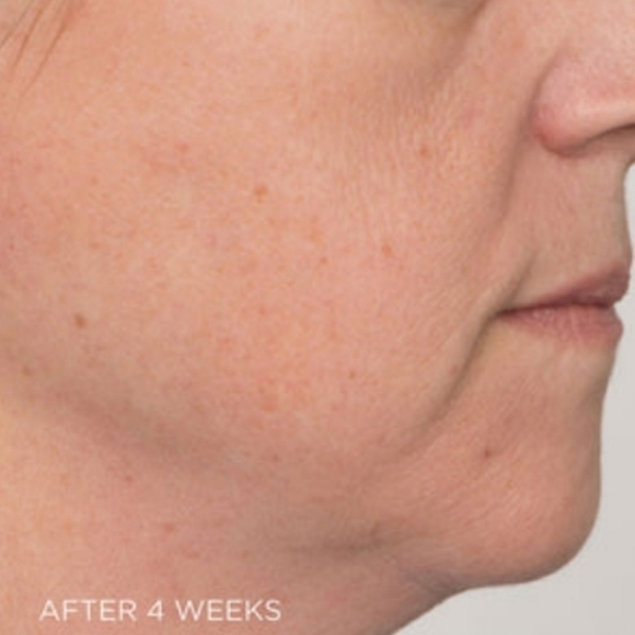 Dr Brandt DNA Do Not Age Time Defying Cream Anti-Aging Moisturizer - Picture 7 of 8